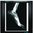 agfa Dry Digital X ray Film For Medical , CE / SFDA / ISO 13485