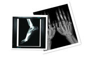 Hosipital PET Film Medical X Ray Paper Waterproof  8 ×10 Inch CT Film White