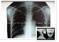 Digital Medical X Ray Dry Film 14 x 17inch Health Imaging Radiographic Film