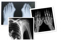 Thermal Digital X Ray Film Fuji Medical For Radiography Examination