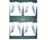 White Base Medical X Ray Paper Film Moistureproof For Sony / EPSON Laser Printer