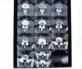 10in * 12in 11in * 14in High Density Medical Imaging Dry Films For AGFA / Fuji Printer