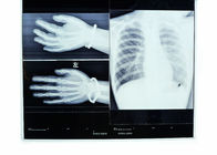 Medical Imaging X Ray Dry Film 14 x 17 Konida , High Density