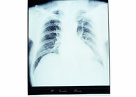 High Sharpness Medical Diagnostic Imaging , Dry AGFA X Ray Film