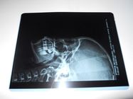 Konida Low Fog Medical Dry Imaging Film For X Ray Examination