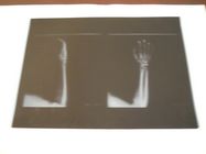 KND-A Low Fog Medical Dry Imaging Film For X Ray Examination On AGFA 5300 11in × 14in