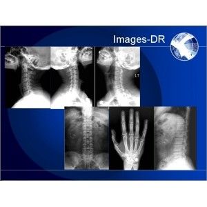 Mammogrpahy X-RAY Digital Radiography Machine With Flexible UC Arm