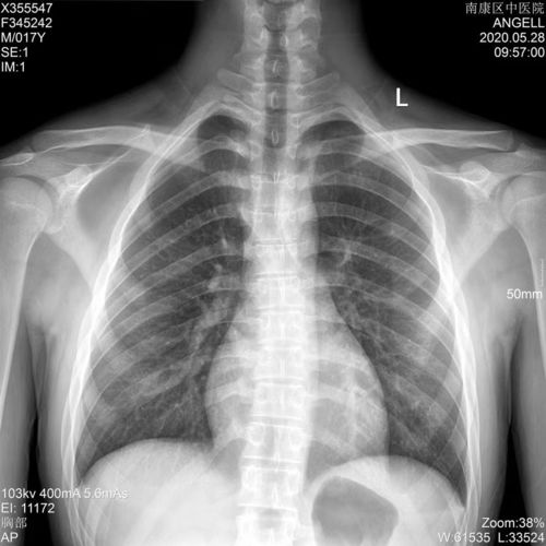 Latest company blogs about Medical X-Ray Film