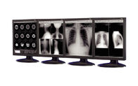 Anti-reflective Medical Grade Displays used in medical imaging equipment