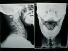 High Density Medical Imaging Film X Ray Dry For Fuji 3000 / 2000 / 1000