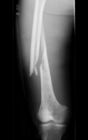 Konida Laser X Ray Medical Imaging