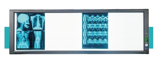 Good price LED medical super bright viewer box online