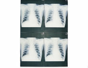 Wearable White Base Medical X Ray Films , Medical Imaging X-ray Paper Film