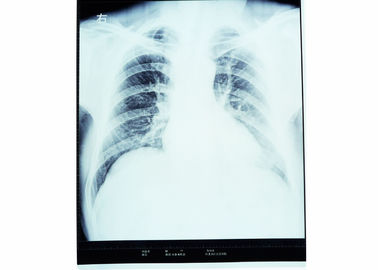 Good price Dry X Ray Medical Diagnostic Imaging Radiology For AGFA / FUJI 2000 online