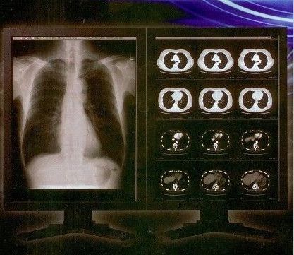 Bright Clear Digital X Ray Film , Konida Medical Laser Transparency Film