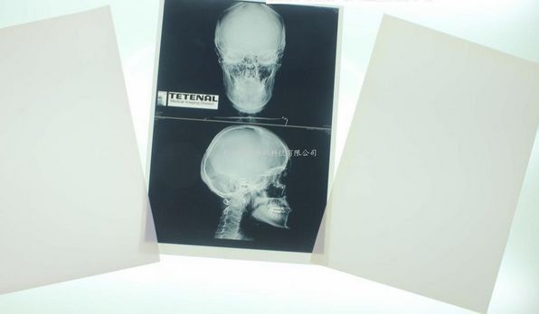 11 x 14 Laser Medical Diagnostic Imaging For Konida Laser Printer