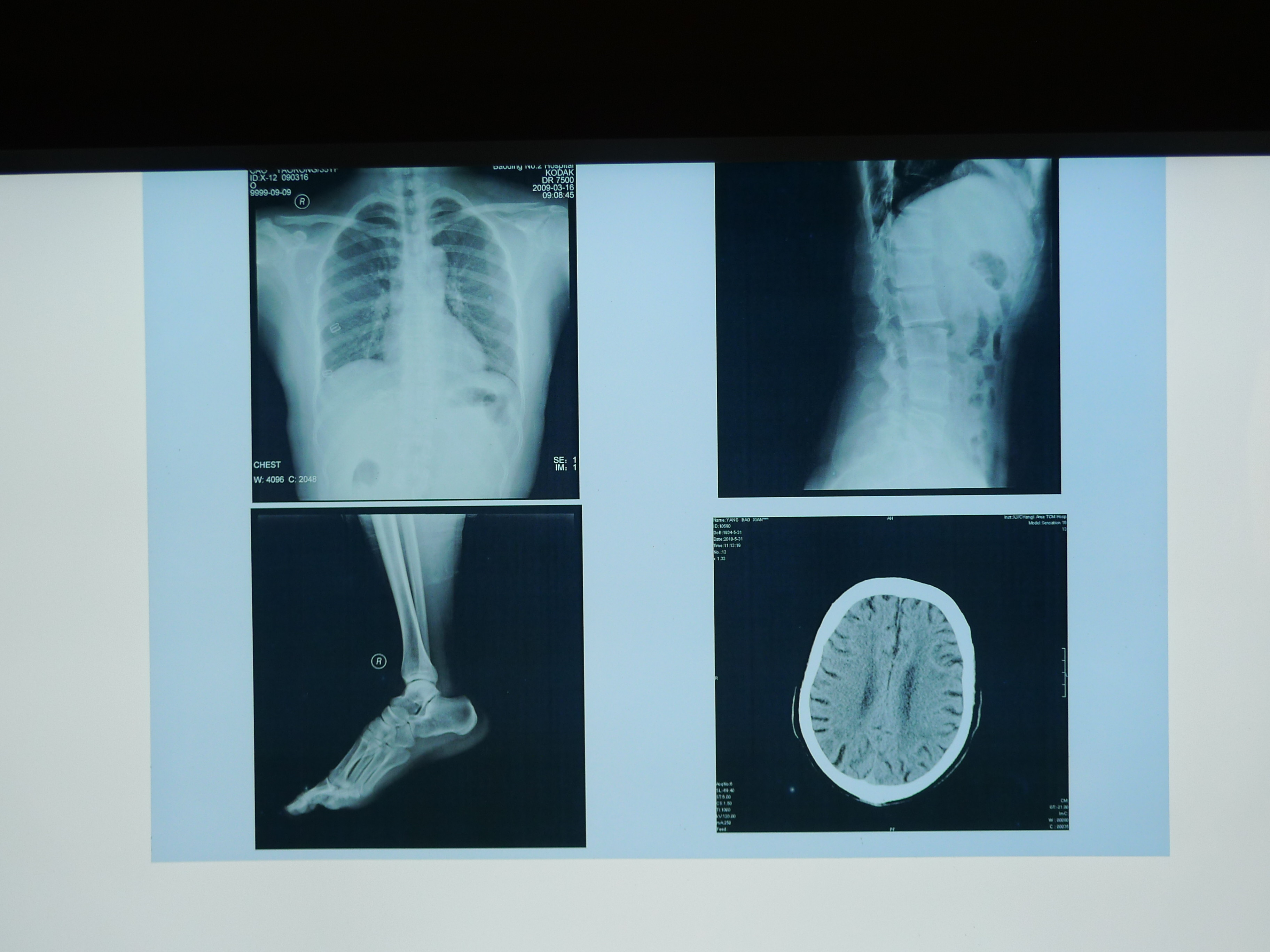 Konida X-Ray Medical Imaging Film