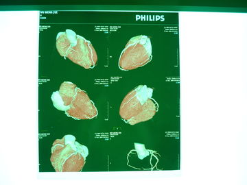 Medical Digital X Ray Dry Film , Dt2b / Dt1b Agfa Medical Dry Imaging Film