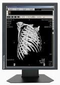 Good price 850cd/m2 Typ  Brightness Medical Grade Displays 20.1