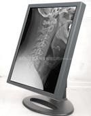 Anti-screen scratches Grade Displays , Contrast Ratio 900:1 Typ Medical Grade Displays