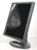 Medical Grade Monitor Displays