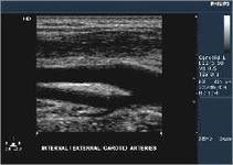 Medical Monitor Grade Displays