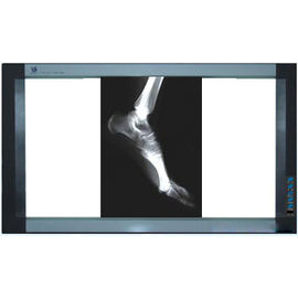 Holographic Medical Imaging Film , Thermal Printers PET X Ray Film