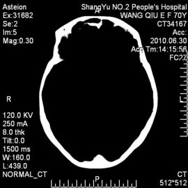 Good price Konida Digital X-ray Medical Dry Thermal Printer Film KND-A, KND-F online