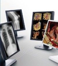 Good price Clear picture Medical Grade Displays , 5MP Gray Scale Medical Display online