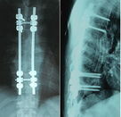 Good price Sharp Dry Digital X Ray Film Radiological For Fujifilm Instax 2000 online