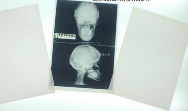 Good price Degradable White Base Xray Paper Medical Film For Laser Printer online