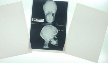 Good price 11 x 14 Laser Medical Diagnostic Imaging For Konida Laser Printer online