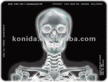 Good price Medical X Ray Thermal Printer Film KND-F25*30cm online