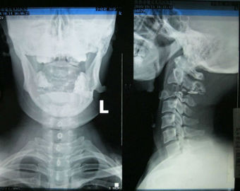 Good price High Sharpness Wearable Konida Medical Imaging Xray Paper For Laser Printer online