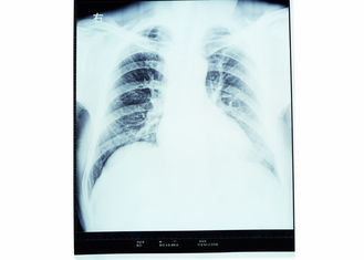 Good price Konida Dry Imaging Film , Medical Paper Laser Imaging Film online