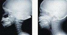 Good price High Ink Coverage X Ray Diagnostic Imaging , 35 x 43cm Laser Medical x ray Film online