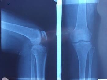 Good price Blue X Ray Diagnostic Imaging , Medical Laser Paper Xray Photographic Film online
