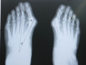 Good price Waterproof X Ray Diagnostic Imaging online