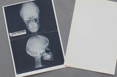 Good price Degradable White Base PET Material  X ray Paper Medical  Film online