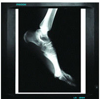 Good price 20cm x 25cm Medical Diagnostic Imaging , Laser Printer Film X Ray Paper online