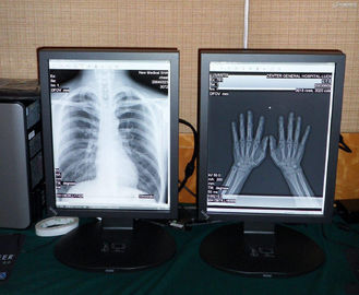 Good price medical high quality 2MP Color medical display online