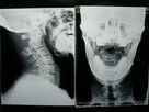Good price High Density Medical Imaging Film X Ray Dry For Fuji 3000 / 2000 / 1000 online