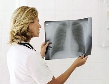 Good price 20cm X 25cm X Ray Diagnostic Imaging online