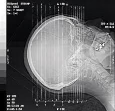 Good price Silver Halide Laser X Ray Diagnostic Imaging , A3 / A4 Waterproof Transparency Film online
