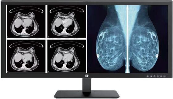 Good price High-Definition Medical Display with DICOM Compliance for Radiology Grade Imaging online