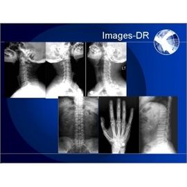 Good price Mammogrpahy X-RAY Digital Radiography Machine With Flexible UC Arm online