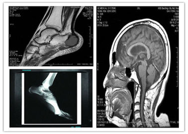 Medical Digital Blue Base Dry Imaging Film 8 x 10in Compatible Hosipital Mri Scan