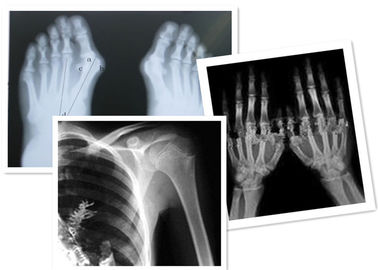 Good price Thermal Digital X Ray Film Fuji Medical For Radiography Examination online