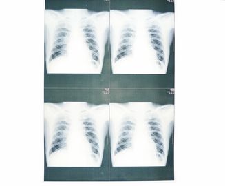 Good price White Base Medical X Ray Paper Film Moistureproof For Sony / EPSON Laser Printer online