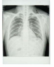 Custom 25cm * 30cm White Base Xray Paper Medical Film with PET materials